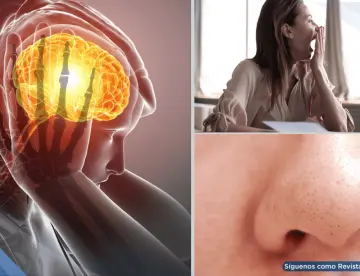 Señales como bostezos, confusión y alucinaciones olfativas pueden anticipar una crisis de migraña