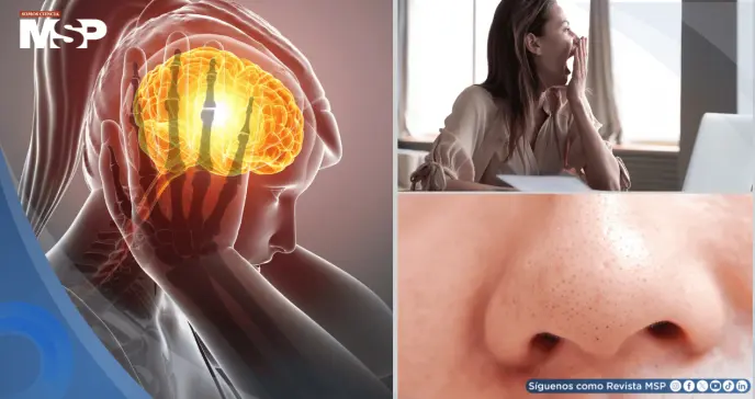Señales como bostezos, confusión y alucinaciones olfativas pueden anticipar una crisis de migraña