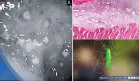 Neumonía bacteriana y colitis por C. difficile en mujer de 55 años tras tos, fiebre y disnea progresiva