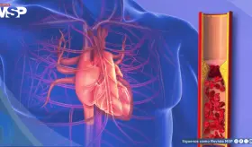 Valores saludables de la presión arterial: Aprende a medirla correctamente y prevenir complicaciones