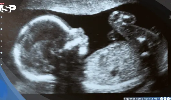 Infecciones durante el embarazo se vincularían con mayor riesgo de de autismo y esquizofrenia
