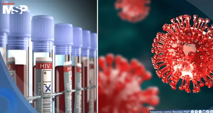 Logran exponer al VIH oculto en células humanas con nanopartículas de ARNm: Un paso hacia posible cura