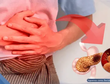 Buen cepillado de dientes y uso de hilo dental podría prevenir el cáncer de páncreas: estudio