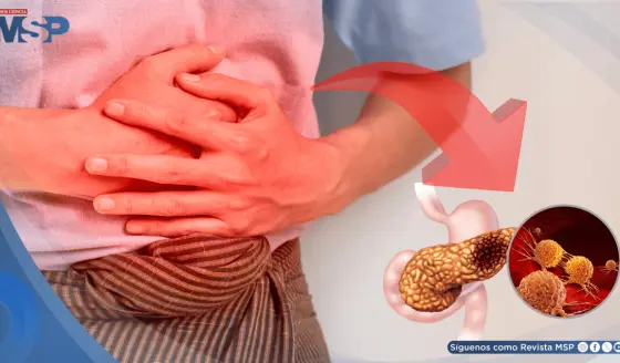 Buen cepillado de dientes y uso de hilo dental podría prevenir el cáncer de páncreas: estudio