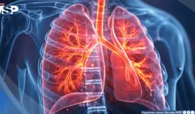 La gripe debilitaría la microbiota pulmonar y abriría la puerta a neumonías e infecciones graves