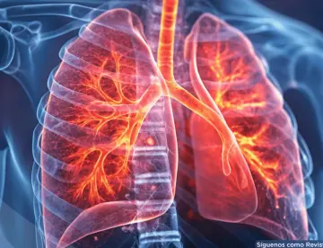 La gripe debilitaría la microbiota pulmonar y abriría la puerta a neumonías e infecciones graves
