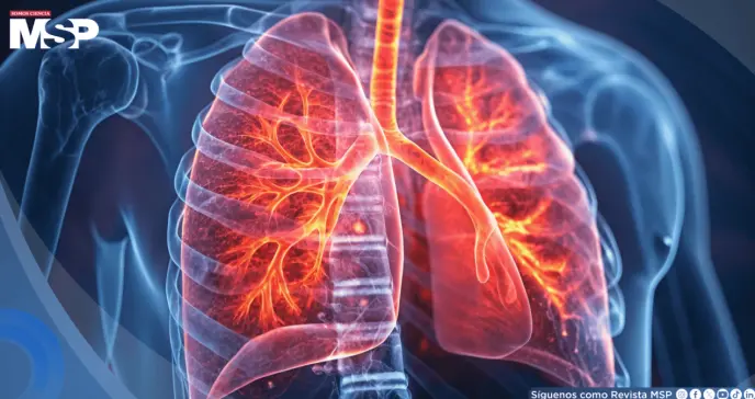 La gripe debilitaría la microbiota pulmonar y abriría la puerta a neumonías e infecciones graves