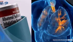 Albuterol: Así podría reducir los temblores, palpitaciones y demás efectos secundarios