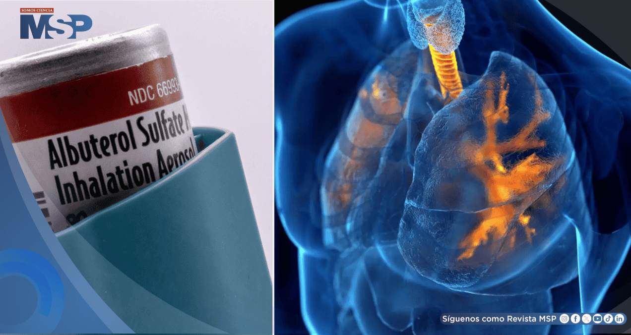 Albuterol: Así podría reducir los temblores, palpitaciones y demás efectos secundarios