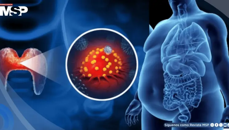 Inflamación crónica por obesidad y diabetes aceleraría el cáncer de tiroides Inflamación crónica por obesidad y diabetes aceleraría el cáncer de tiroides
