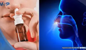 Así puede diferenciar la rinitis de un resfriado: Síntomas, duración y tratamiento