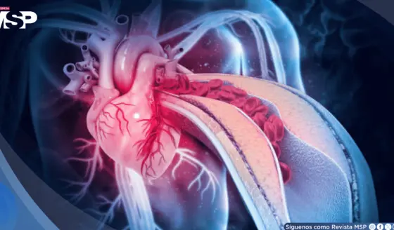 La anemia y las infecciones estarían causando más ataques al corazón en mujeres que la placa arterial