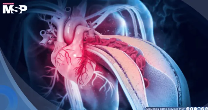 La anemia y las infecciones estarían causando más ataques al corazón en mujeres que la placa arterial