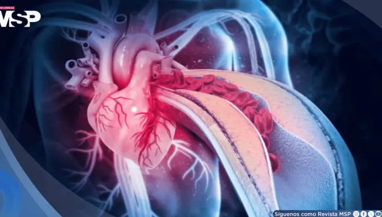 La anemia y las infecciones estar&iacute;an causando m&aacute;s ataques al coraz&oacute;n en mujeres que la placa arterial