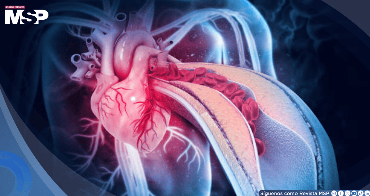 La anemia y las infecciones estarían causando más ataques al corazón en mujeres que la placa arterial