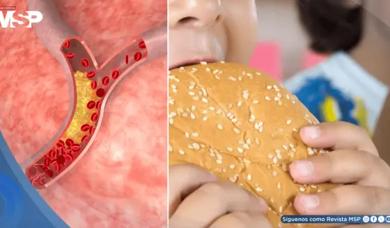 Colesterol alto desde la niñez duplicaría el riesgo de infartos tempranos en adultos jóvenes
