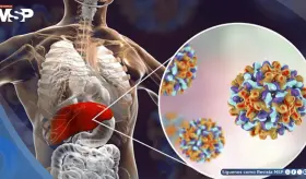 Iniciar el tratamiento de hepatitis C durante la hospitalización posparto mejora tasas de curación