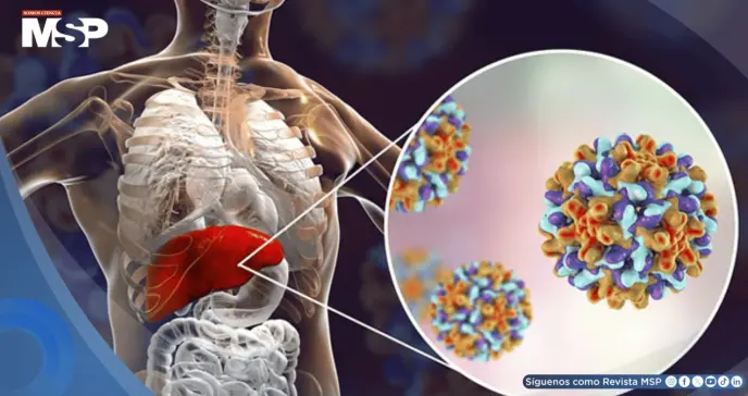 Iniciar el tratamiento de hepatitis C durante la hospitalización posparto mejora tasas de curación