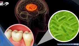 Descubren que esta bacteria común en la boca podría relacionarse con la enfermedad de párkinson
