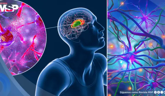Hito médico: Logran ralentizar en 75% la progresión de la enfermedad de Huntington