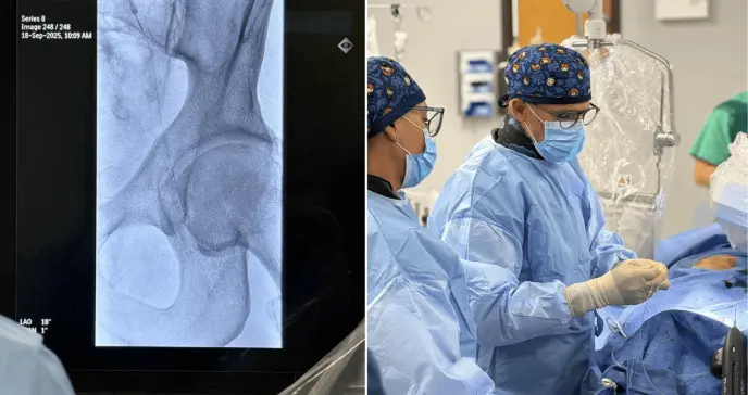 HT Command: Inician producción de cables guía avanzados para procedimientos cardiovasculares en la isla