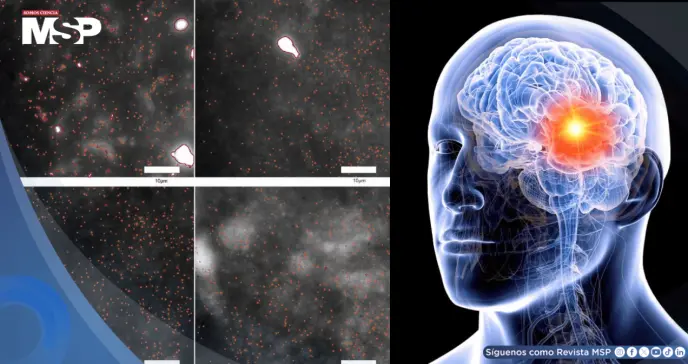 Detectan por primera vez los oligómeros de alfa-sinucleína, proteínas que marcan el inicio del párkinson