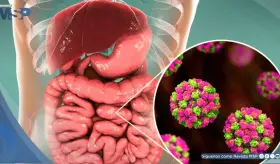 Norovirus: Cómo se transmite, cuáles son los síntomas y cómo prevenirlo