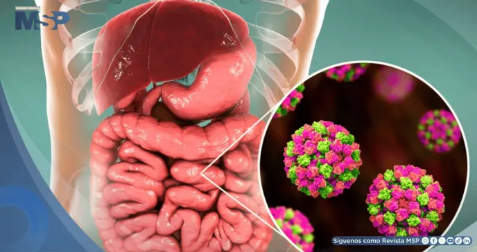 Norovirus: Cómo se transmite, cuáles son los síntomas y cómo prevenirlo