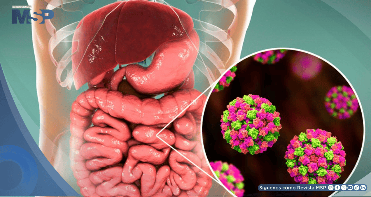 Norovirus: Cómo se transmite, cuáles son los síntomas y cómo prevenirlo
