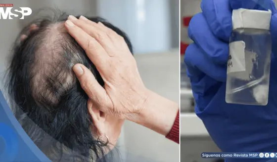 Desarrollan gel experimental que podría prevenir la caída de cabello durante la quimioterapia
