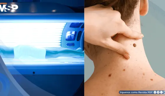 Expertos exigen prohibir las cabinas de bronceado por aumentar el riesgo de melanoma