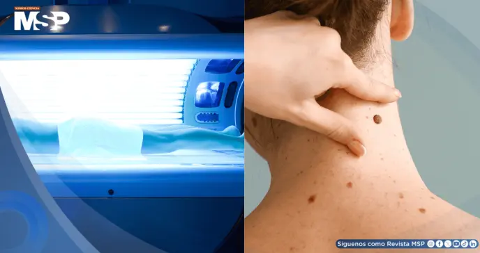 Expertos exigen prohibir las cabinas de bronceado por aumentar el riesgo de melanoma