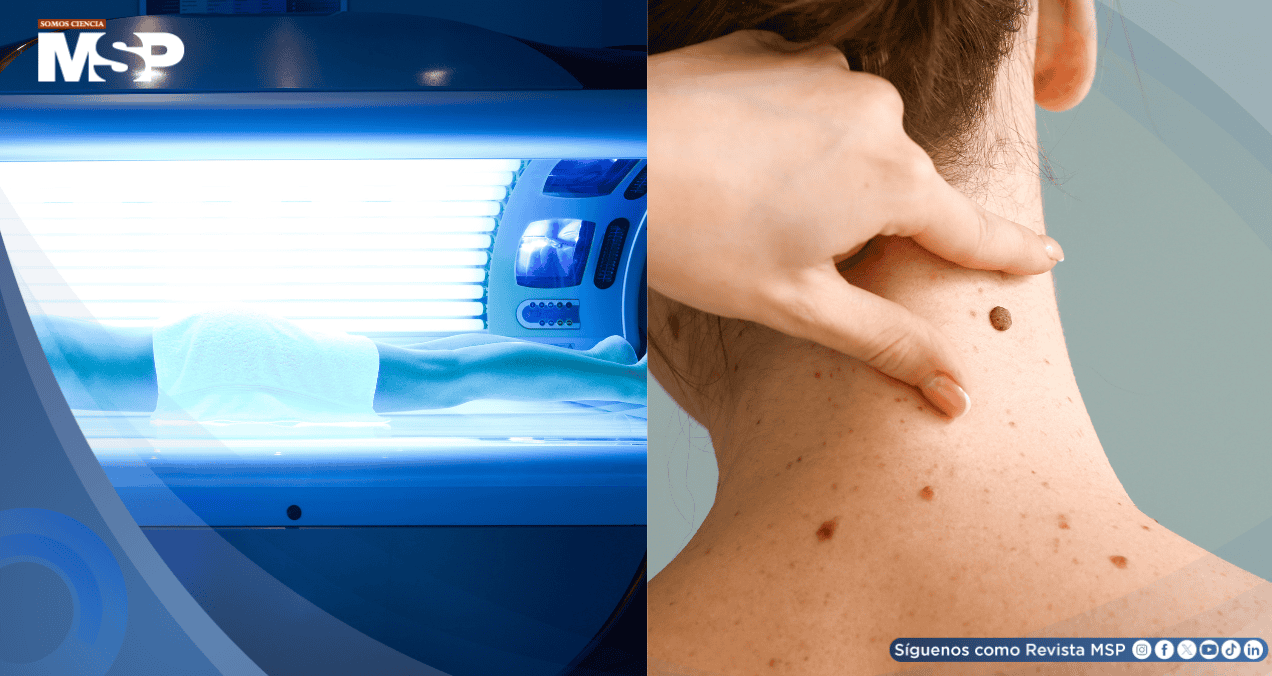 Expertos exigen prohibir las cabinas de bronceado por aumentar el riesgo de melanoma