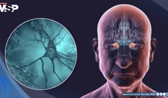 Por primera vez, ralentizan la progresión del alzhéimer: nuevos tratamientos y diagnóstico a tiempo