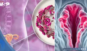 Picazón, irritación e inflamación en la vulva: Así podría manifestarse la dermatitis vulvar