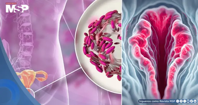 Picazón, irritación e inflamación en la vulva: Así podría manifestarse la dermatitis vulvar
