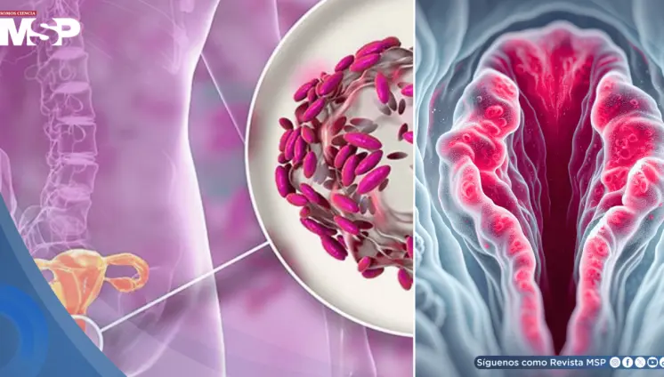 Picazón, irritación e inflamación en la vulva: Así podría manifestarse la dermatitis vulvar Picazón, irritación e inflamación en la vulva: Así podría manifestarse la dermatitis vulvar