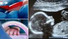 Químicos presentes en esmalte gel de uñas alterarían sistema hormonal y pondrían en riesgo la fertilidad