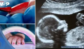 Químicos presentes en esmalte gel de uñas alterarían sistema hormonal y pondrían en riesgo la fertilidad