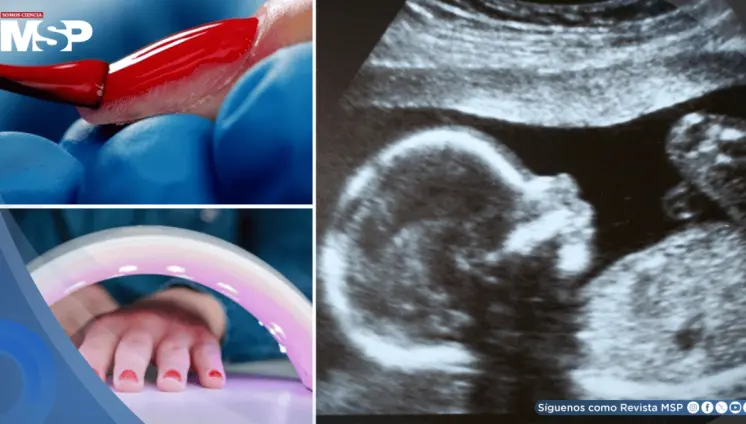 Químicos presentes en esmalte gel de uñas alterarían sistema hormonal y pondrían en riesgo la fertilidad