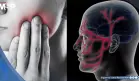 Dolor facial súbito o ´descarga eléctrica´ en el rostro: Así se reconoce la neuralgia del trigémino