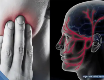 Dolor facial súbito o ‘descarga eléctrica’ en el rostro: Así se reconoce la neuralgia del trigémino
