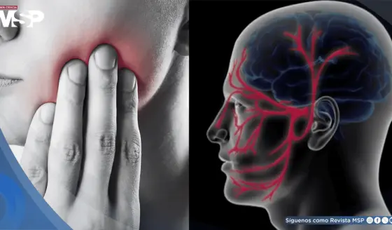 Dolor facial súbito o ´descarga eléctrica´ en el rostro: Así se reconoce la neuralgia del trigémino