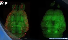 Logran revertir el alzhéimer en roedores mediante una terapia con nanopartículas bioactivas