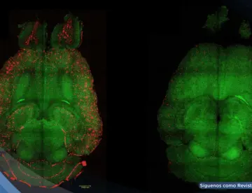 Logran revertir el alzhéimer en roedores mediante una terapia con nanopartículas bioactivas