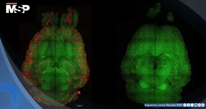 Logran revertir el alzhéimer en roedores mediante una terapia con nanopartículas bioactivas