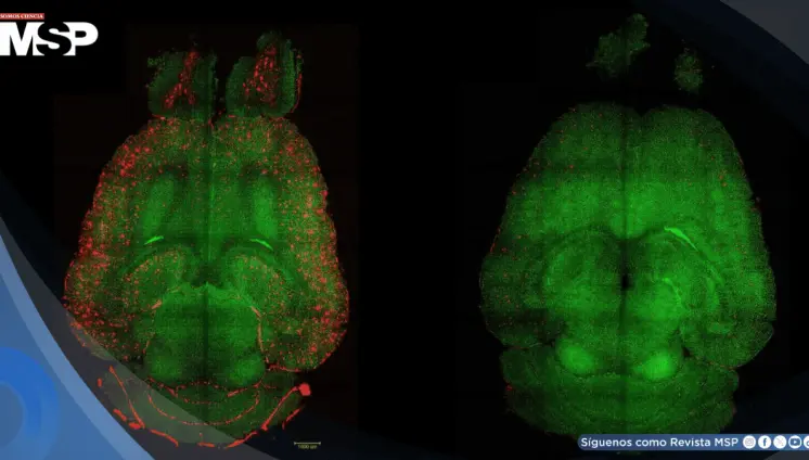 Logran revertir el alzhéimer en roedores mediante una terapia con nanopartículas bioactivas