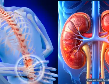 ¿Dolor de espalda o problema renal? Reconoce las señales que alertan sobre una afección en el riñón 