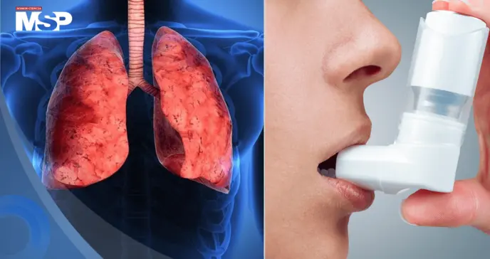 Inhaladores para el asma y la EPOC emiten más de 2 millones de toneladas de CO2 al año: Estudio 