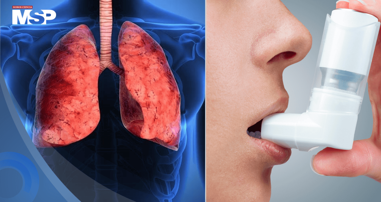 Inhaladores para el asma y la EPOC emiten más de 2 millones de toneladas de CO2 al año: Estudio 